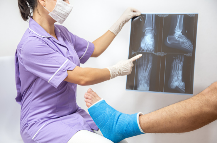 Complex Fracture Care