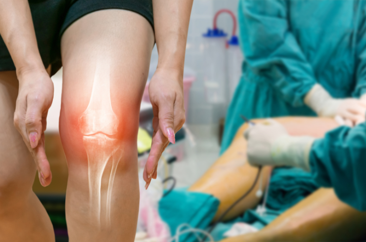 Joint Replacement Surgeries